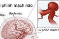 Bỏ qua cơn đau đầu, bé gái gục chết sau câu: “Con không khỏe!”