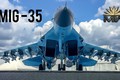 “Vịt con xấu xí” của Không quân Nga hóa thành “thiên nga xinh đẹp“