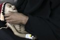 Thảm cảnh những “cụ nhăn nheo” sơ sinh ở Yemen