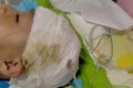 Trung Quốc: Hiệu trưởng đánh nam sinh 10 tuổi vỡ mạch máu não