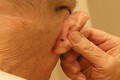 Dấu hiệu cơ bản của ung thư tai