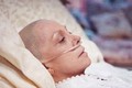 Biểu hiện của bệnh nhân ung thư giai đoạn cuối 
