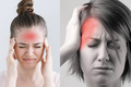 Cơn đau đầu ở những vị trí khác nhau phản ánh điều gì? 