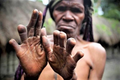 Kỳ lạ bộ tộc cắt một đốt ngón tay khi người thân qua đời