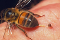Cách xử lý khi bị ong đốt nhất định phải nhớ