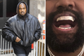 Chi 850.000 USD để độ răng, Kanye West đối mặt hiểm họa 