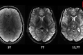 Siêu máy quét MRI cho hình ảnh rõ nét nhất về bộ não người
