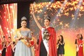 Hoa hậu Hoàn cầu Trung Quốc 2015 bị chê răng hô