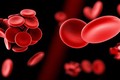 Dấu hiệu của bệnh cục máu đông và cách điều trị