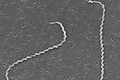 Suýt mất mạng do nhiễm Leptospira - hiểm hoạ từ chuột, ai dễ mắc?