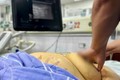 Suy gan nguy kịch do chủ quan với viêm gan B