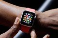 9 sự cố khiến khách ngán đồng hồ thông minh Apple Watch