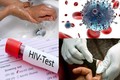 Ngay khi phát hiện phơi nhiễm HIV, cần phải làm gì?