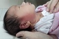 Xỏ lỗ tai, bé 15 ngày tuổi suýt chết 