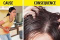 Dấu hiệu mái tóc cảnh báo sức khoẻ bạn có vấn đề