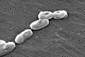 Sự thật kinh hoàng về loại vi khuẩn “ăn thịt người” đang hoành hành trở lại