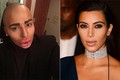 Fan cuồng Kim Kardashian phá nát khuôn mặt để giống thần tượng