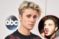 Justin Bieber đấm fan chảy máu miệng