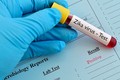 TP HCM có thêm 2 thai phụ nhiễm Zika