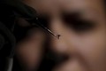Trẻ sơ sinh nhiễm virus Zika có bị dị tật đầu nhỏ?