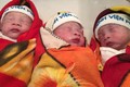 Cực hiếm 3 bé sinh ba chào đời nguyên bọc ối ở VN
