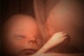 Tan chảy với hình ảnh đáng yêu của các bé song thai, đa thai trong bụng mẹ