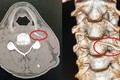 Uống "nước thần" chữa hóc xương, người đàn ông nhập viện khẩn cấp