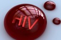 Cần làm gì khi bị dính máu nghi nhiễm HIV?