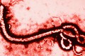 Lý giải nhiều bệnh nhân thoát chết khi nhiễm Ebola