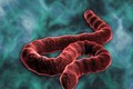 Trung Quốc dễ có nguy cơ bùng phát đại dịch Ebola
