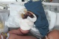 Bé sơ sinh bị hoại tử ngón tay có thể phải tháo khớp