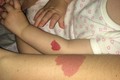 Bí ẩn hiện tượng “con ranh, con lộn”, chuyên gia lý giải sao?