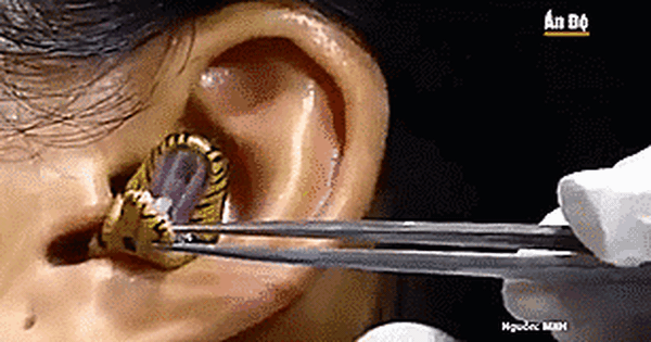Xôn xao clip rắn chui vào tai người không chịu ra