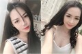 Hot girl Nam Định ước tính "xây lại mặt" hết 1,5 tỷ