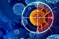 Các nhà khoa học loại bỏ 99% tế bào ung thư bằng kỹ thuật mới