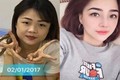 9X mắt một mí xinh như hot girl sau khi "dao kéo"