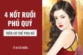 4 nốt ruồi trên người phụ nữ càng đen càng có tiền