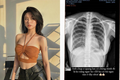 Bị antifan hỏi chuyện nâng ngực, Hàn Hằng show ảnh làm netizen ngã ngửa