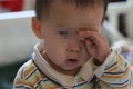 Bé trai 2 tuổi suýt bị mù vĩnh viễn chỉ vì bố mẹ 'lười'