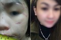 Bé 10 tuổi bị bạo hành: Mẹ kế vẫn lên Facebook khoe bảng điểm của con