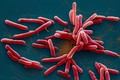 Phát hiện bệnh nhân nhiễm “vi khuẩn ăn thịt người” tại Buôn Ma Thuột