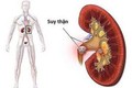Những thói quen xấu “âm thầm” gây suy thận