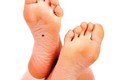 Bàn chân có 4 dấu hiệu này đều hưởng phúc khí sâu dày