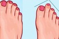 Trắc nghiệm tâm lý: Bàn chân của bạn có hình dạng nào sau đây? 