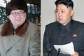 Nhà lãnh đạo Kim Jong-un ngày càng "phát tướng"
