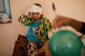 Ảnh xót xa trẻ em Mosul suy dinh dưỡng trong bệnh viện