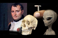 Nóng: Người ngoài hành tinh "cả gan" cấy vi mạch vào hộp sọ Napoleon? 