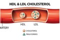 Căn cứ đo lượng cholesterol trong máu