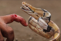 Bị rắn cắn, có nên dùng miệng hút nọc độc?