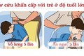 Trẻ tử vong do sặc cháo: Cấp cứu kịp thời có thể cứu mạng trẻ